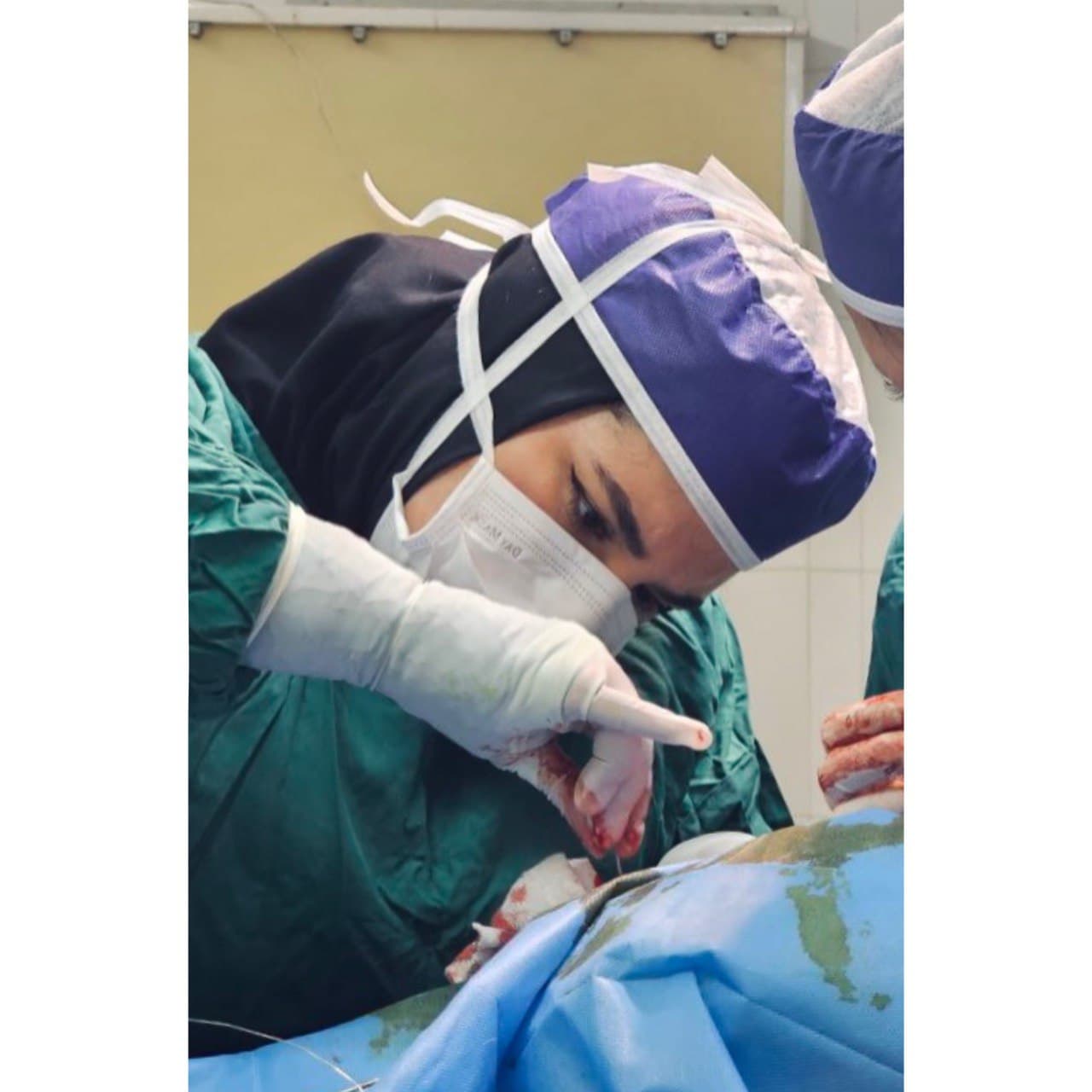 Dr. Ahmadi during a surgical procedure